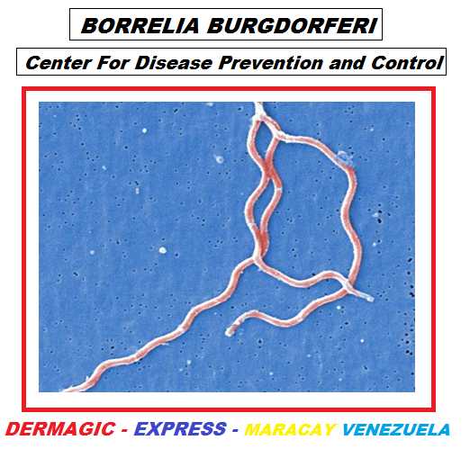 Borrelia Burgdorferi, etiological agent of LYME'S DISEASE, transmitted by the bite of a TICK