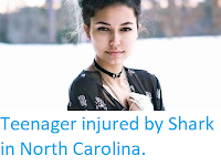 https://sciencythoughts.blogspot.com/2019/06/teenager-injured-by-shark-in-north.html