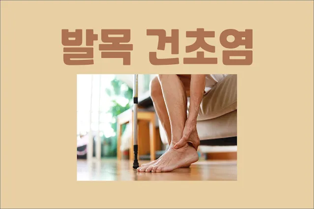 발목-건초염
