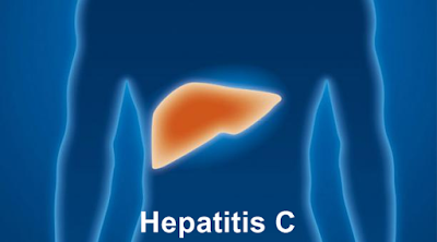 Virus Hepatitis C