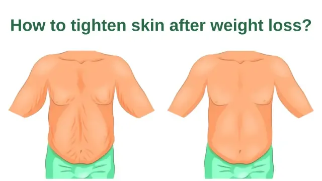 How to tighten skin after weight loss