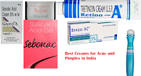 Best Creams for Acne and Pimples in India