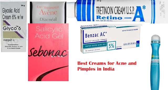 Best Creams for Acne and Pimples in India