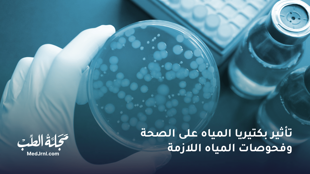 تأثير بكتيريا المياه على الصحة وفحوصات المياه اللازمة