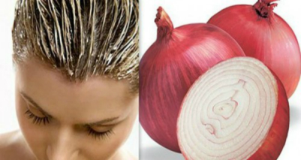 ONION WITH THIS RECIPE YOUR HAIR WILL GROW LIKE CRAZY! 100% WORKING