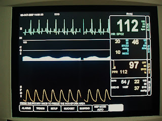 Russell Vale Animal Clinic anaesthetic monitoring