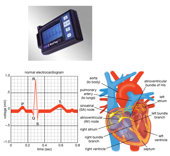 Holter