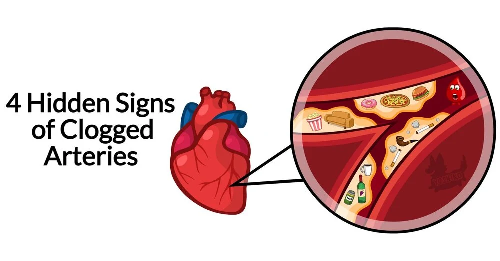 4 Hidden Signs of Clogged Arteries and the Best Foods to Prevent Them
