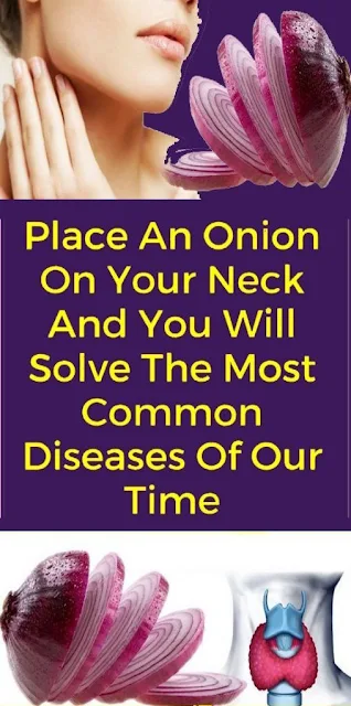 Apply Onions on Your Neck at Night to Get Rid of This Disease