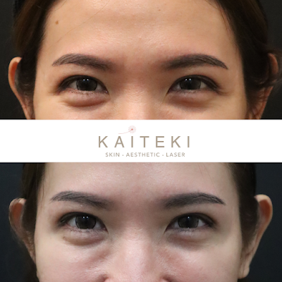 kaiteki skin aesthetic clinic ss2 review
