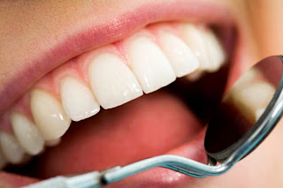 Here’s Home Remedies For Swollen Gums (part 3)