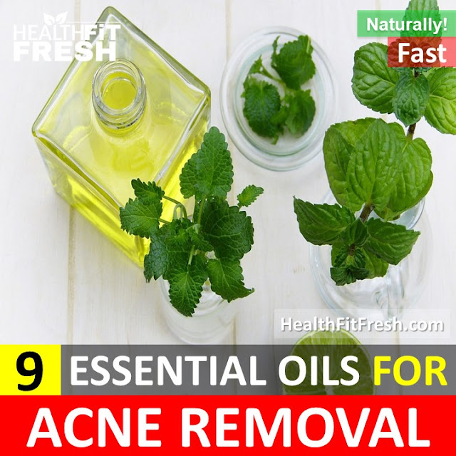 Essential Oils for Acne, How to get rid of acne, home remedies for acne, get rid of pimples, remove acne fast, overnight acne treatment, acne removal, acne scars, ways to remove acne, ways to clear acne, remove acne overnight, 