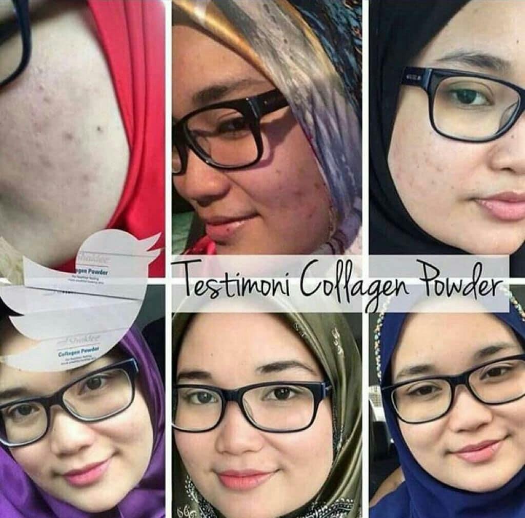 testimoni set cantik shaklee set cantik bajet shaklee set cantik shaklee new packaging harga set kecantikan shaklee set kulit cantik shaklee bajet Set Cantik Shaklee [Fungsi, Keistimewaan dan Harga, collagen shaklee tak berkesan  cara makan collagen shaklee  harga collagen shaklee  harga collagen shaklee 2020  collagen plus powder shaklee  testimoni collagen plus vit e  pengalaman makan collagen shaklee  testimoni esp shaklee