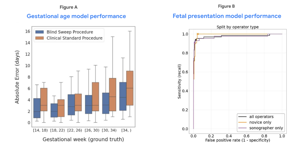 Figure A on the left is a chart sshowing gestatinal age model performance comparing the blind sweep based gestational age with the clinical standard of care method indicating the percentile absolute error in days. Figure B on the right is a graphical representation of the fetal presentation model performance showing the Receiver Operating Characteristic curves for blind sweep based fetal malpresentation for cases collected by novices or expert sonographers.