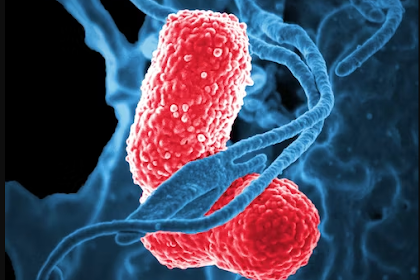 Setelah Teridentifikasi, Enam Kasus Bakteri Pneumonia Mycoplasma pada Anak Sekolah