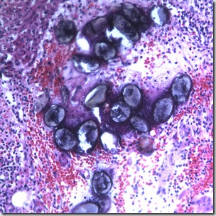 Telur Ascaris Lumbricides di jaringan appendiks