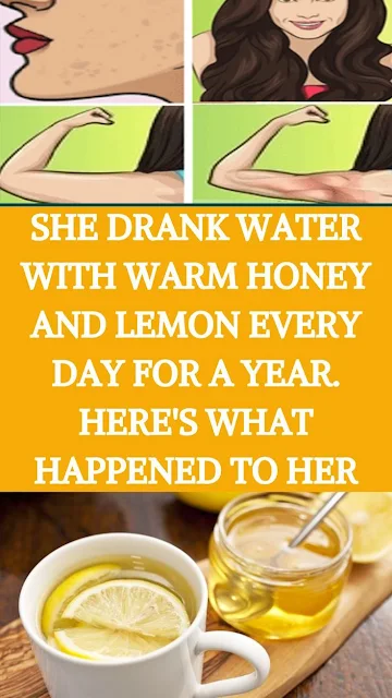 This Woman Drank Honey And Lemon For A Year, Guess What Happened Next