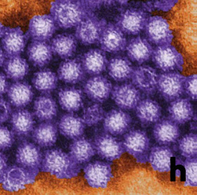 virus norovirus