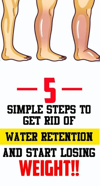 How to Get Rid of Water Retention and Lose Weight With 5 Simple Steps