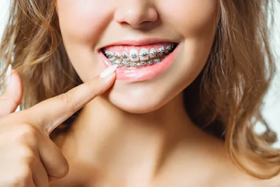 Orthodontist Service in Melbourne