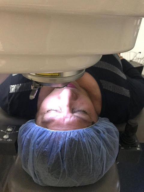 Lasik surgery