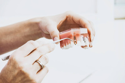 The Beginner's Guide to Dental Bone Graft and Substitutes Market