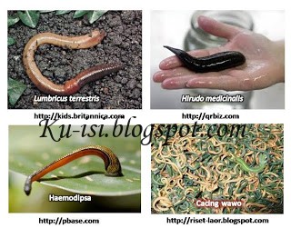 57+ Contoh Hewan Avertebrata Brainly, Info Spesial!