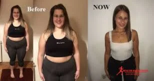 Semaglutide 6-week belly Ozempic weight loss before and after