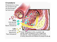 Diet Penderita Kolesterol Jahat