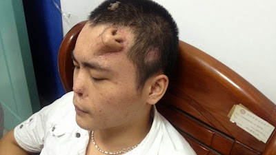 China Man nose on forehead