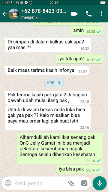 Cara Mengobati Kulit Gatal Perih Karena Herpes