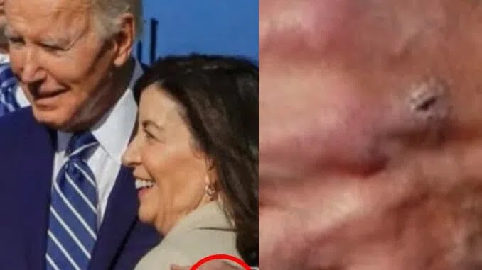 Photo’s Appear To Show IV Punctures On Biden’s Hand & Not For The First Time