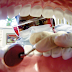 Useful Teeth Tips For You
