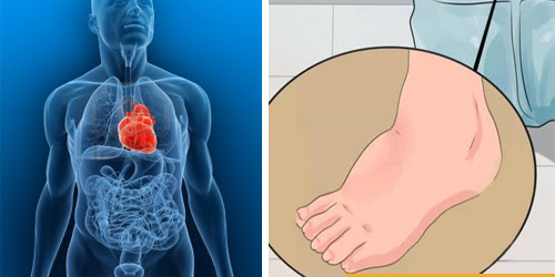 9 signos y síntomas de una deficiencia de potasio que a menudo ignoramos 