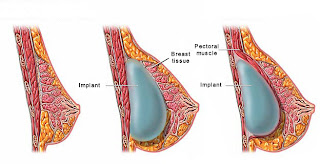 natural way for bigger breast