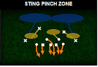 sting-pinch-zone