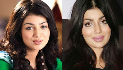 actresses who looks horrible post cosmetic surgery!, ayesha takia plastic surgery, post cosmetic surgery, surgery photos of popular bollywood actresses, plastic surgery photos of popular bollywood actresses, plastic surgery photos, actresses who looks horrible post cosmetic surgery, horrible post cosmetic surgery, surgery gone wrong, bollywood actresses who looks horrible post cosmetic surgery, plastic surgery before and after