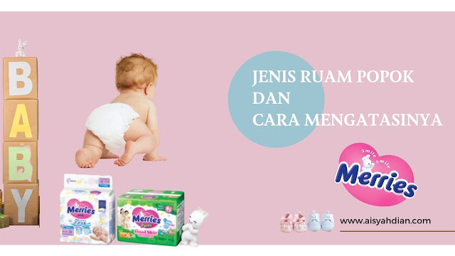 Ruam pada bayi