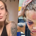 Mulher é agredida pelo namorado com cassetete e soco inglês