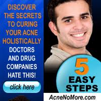 Acne Treatment Acne NoMore