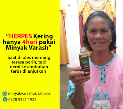 Obat Alami Herpes Cepat sembuh minyak varash