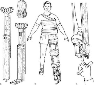 Шины для транспортной иммобилизации конечностей