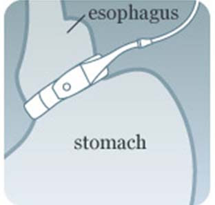 Los Angeles bariatric surgery