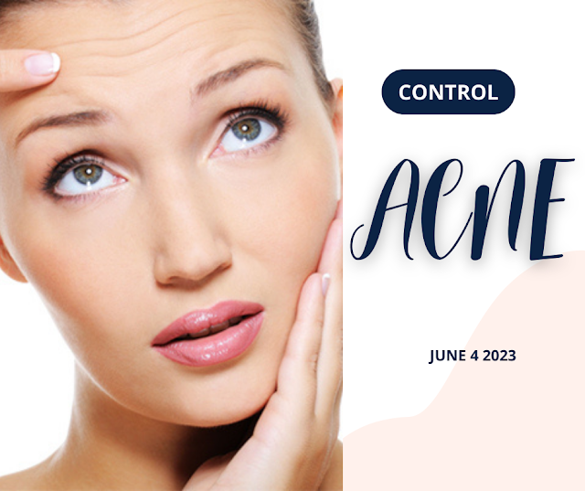 How can we control the acne?