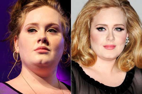 ... What plastic surgeon experts believe about Adele 's plastic surgery