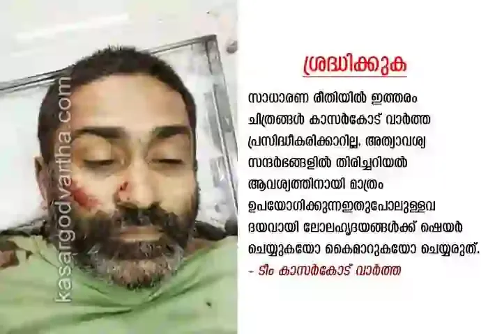 Found-Dead, Train-Hit-News, Mangalpady-News, Man Found Dead, Kerala News, Kasaragod News, Manjeshwaram News, Man found dead on railway track.