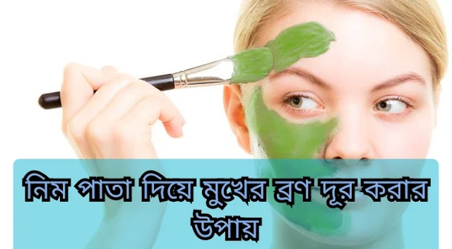 নিম পাতা দিয়ে ব্রণ দূর করার উপায়