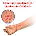 Common skin diseases (Rashes) in Children.