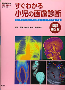 すぐわかる小児の画像診断 改訂第2版 (画像診断別冊KEYBOOKシリーズ)