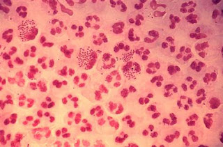 crystal x mampu mencegah bakteri Gonorrhea